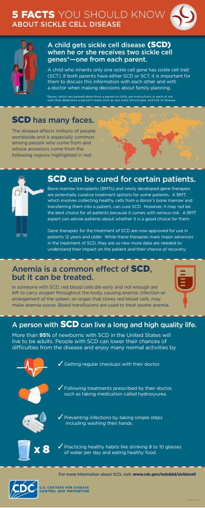 5 Facts You Should Know About Sickle Cell Disease preview