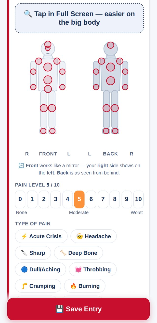 Pain crisis logging on a front and back body map with a 0-10 pain scale